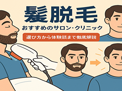 髭 脱毛サロン 失敗しない髭脱毛の始め方！安い・効果的・通いやすいサロン選び完全マニュアル