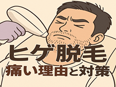 髭 脱毛 痛い リアルな体験談と痛みを軽減する方法まとめ