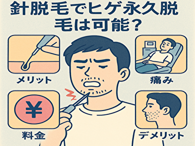 髭 脱毛 針 でヒゲ永久脱毛は可能？メリット・痛み・料金を徹底解説！