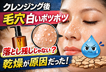 クレンジング後 毛穴 白い ポツポツは落とし残しじゃない？実は乾燥が原因だった対策法